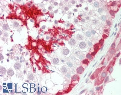 IHC-plus™ Polyclonal Rabbit anti-Human GPI Antibody (IHC, IF, WB)