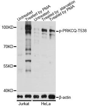 PRKCQ / PKC-Theta Antibody (phospho-Thr538)