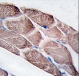 EPM2A / Laforin Antibody (aa288-317)