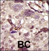 Polyclonal Rabbit anti-Human BTK Antibody (aa209-239, IHC, IF, WB)