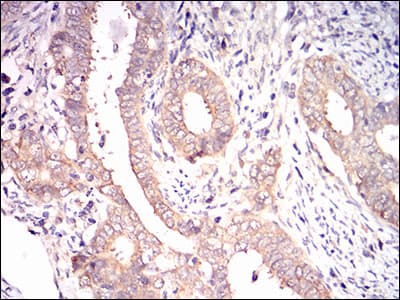EIF2A / EIF2 Alpha Antibody (aa448-576, clone 3A7A8)