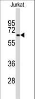 BECN1 / Beclin-1 Antibody