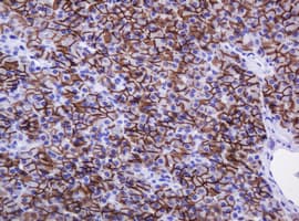 Monoclonal Mouse anti-Human CA12 / Carbonic Anhydrase XII Antibody (clone OTI2C6, IHC, WB)