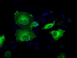 Monoclonal Mouse anti-Human SORD / Sorbitol Dehydrogenase Antibody (clone OTI9E7, IHC, IF, WB)