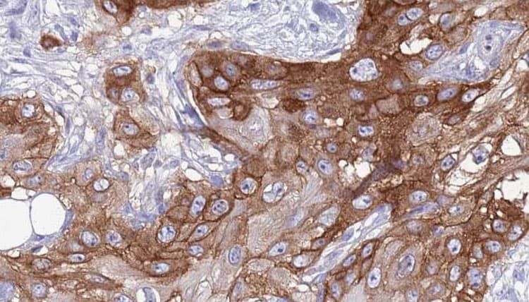 Polyclonal Rabbit anti-Human RGR Antibody (IHC, WB)