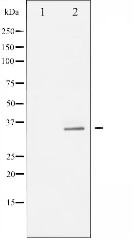 RPS6 / Ribosomal Protein S6 Antibody (phospho-Ser235)