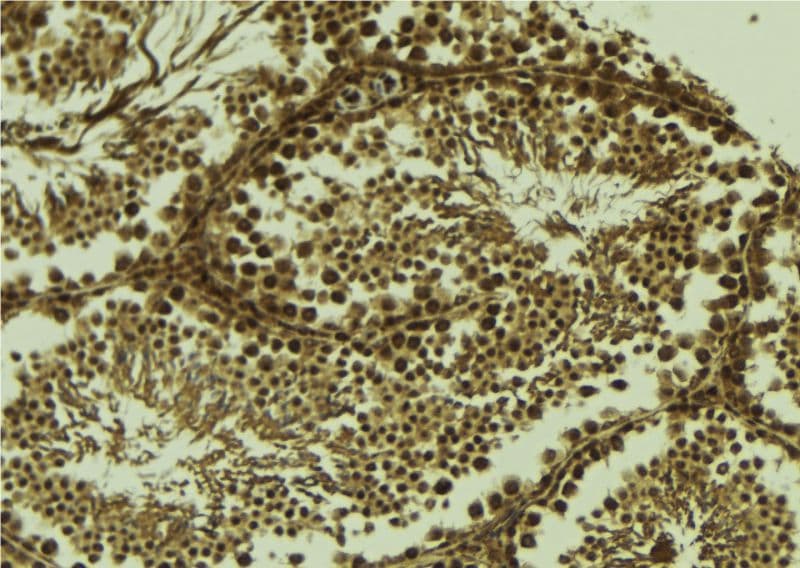 Polyclonal Rabbit anti-Human SCP1 / SYCP1 Antibody (IHC, WB)