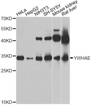 IHC-plus™ YWHAE / 14-3-3 Epsilon Antibody