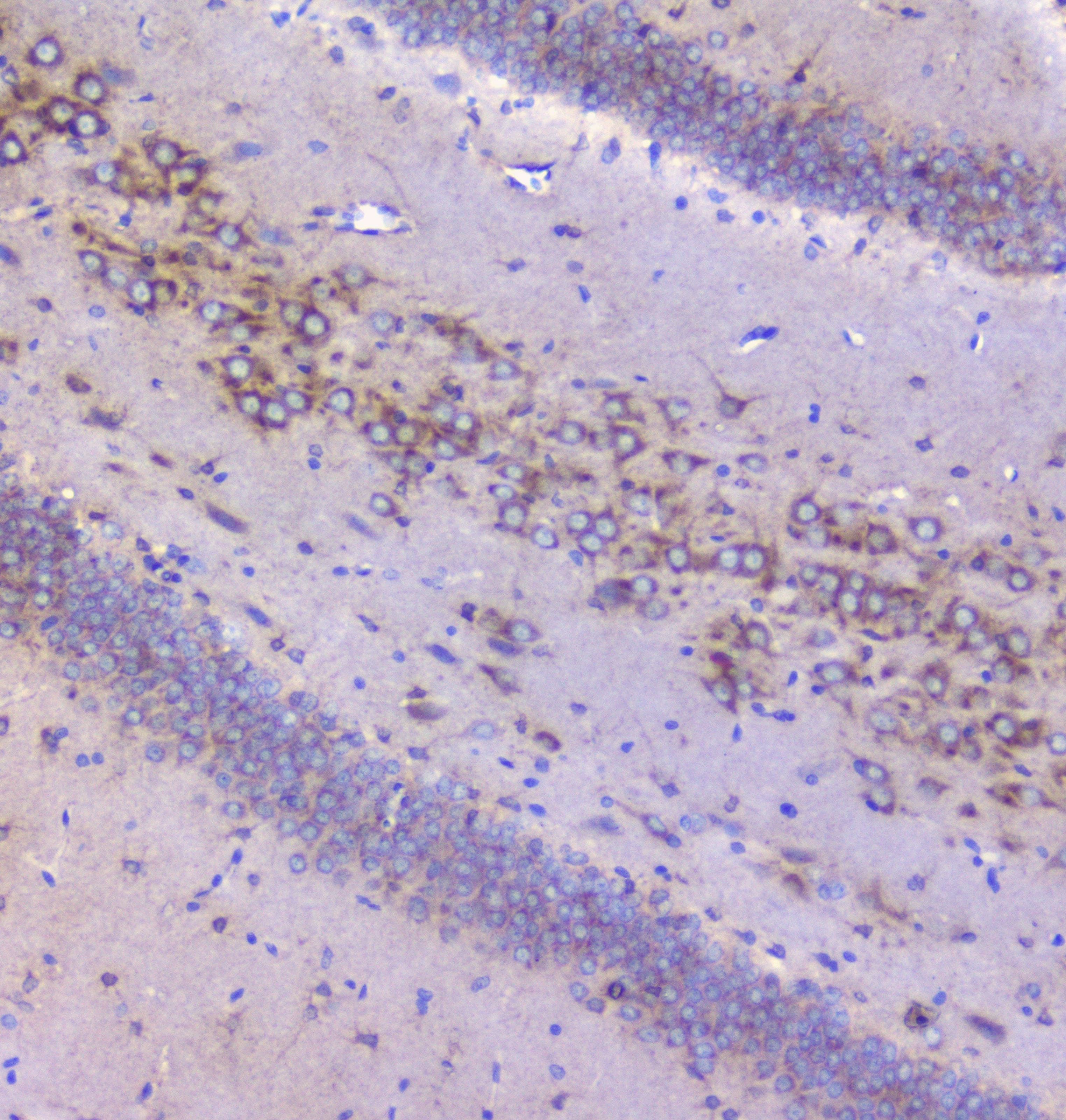 IGF2R / CD222 Antibody