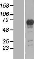 PGM2L1 Protein (Over-Expression Lysate Myc-DDK (Flag))