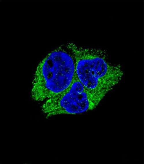 Neuroserpin Antibody (aa19-45)