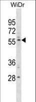 TEM7 Antibody (aa466-494)