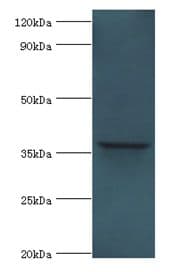 ANXA8L1 Antibody (aa1-276)