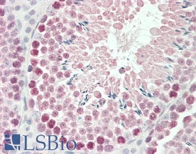 IHC-plus™ Polyclonal Goat anti-Mouse ROBO1 Antibody (aa1417-1428, IHC, WB)