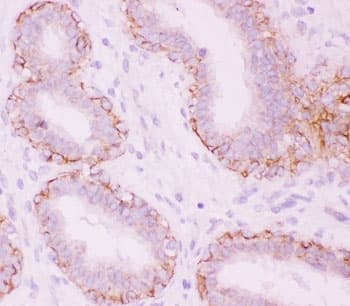 Alpha Catenin Antibody (aa143-292)