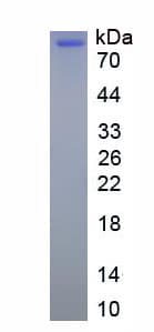 Mouse SORT1 / Sortilin Protein (Recombinant His, N-Terminal)