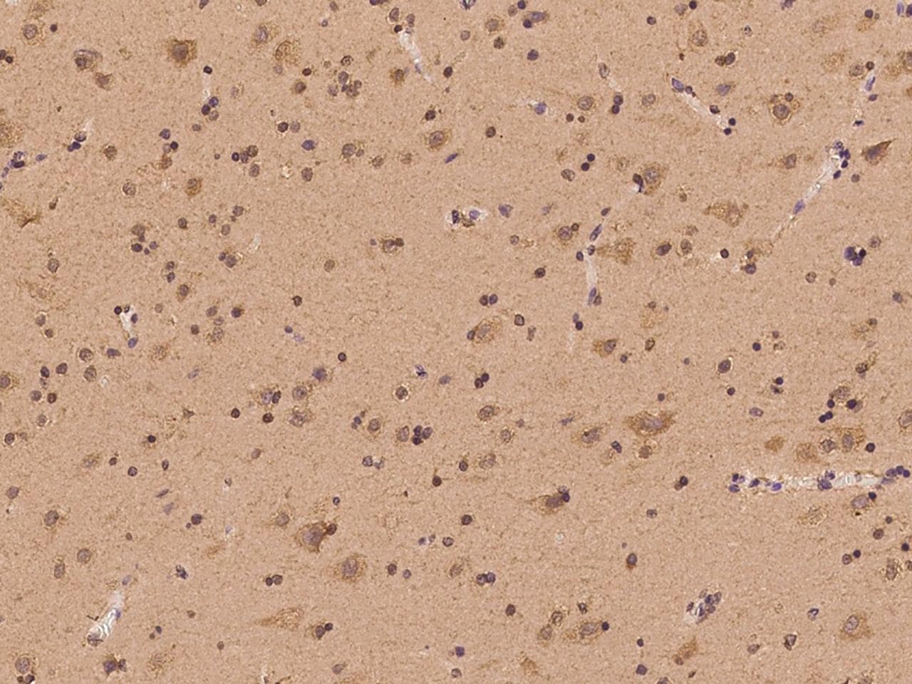 WWP1 Antibody