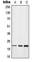 IHC-plus™ MYD118 / GADD45B Antibody (C-Terminus)
