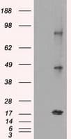 CTAG1B / NY-ESO-1 Antibody (clone OTI3C9)