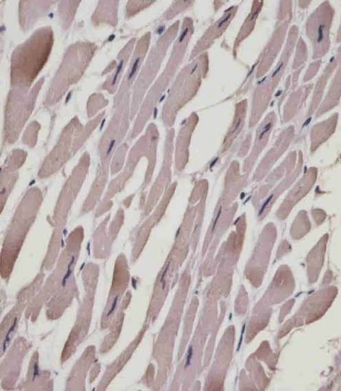 MLC3F / MYL1 Antibody (N-Terminus)