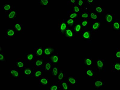 HIST1H4I Antibody