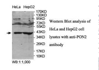 PON2 Antibody (aa42-177)