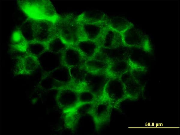 IHC-plus™ TC21 / RRAS2 Antibody (clone 2D3-4B8)