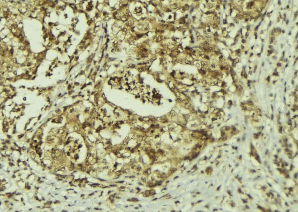 PRPF8 Antibody