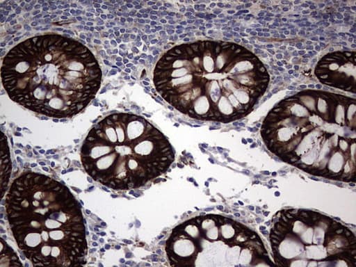 Monoclonal Rat anti-Human Acidic Cytokeratin Antibody (clone 9H3, IHC)