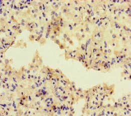 ADCY1 / Adenylate Cyclase 1 Antibody (aa416-610)