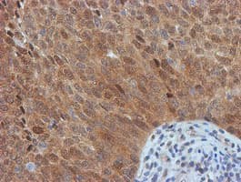 FBXO21 Antibody (clone OTI5H4)