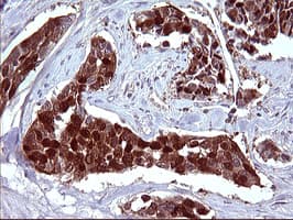 SERPINB3 Antibody (clone OTI1A5)