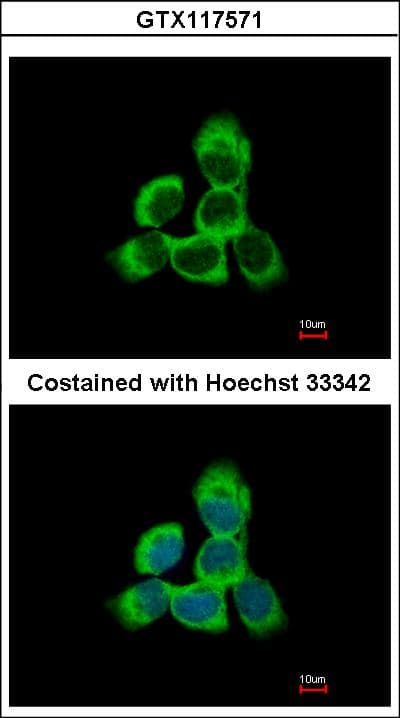Polyclonal Rabbit anti-Human CYGB / Cytoglobin Antibody (IF, WB)