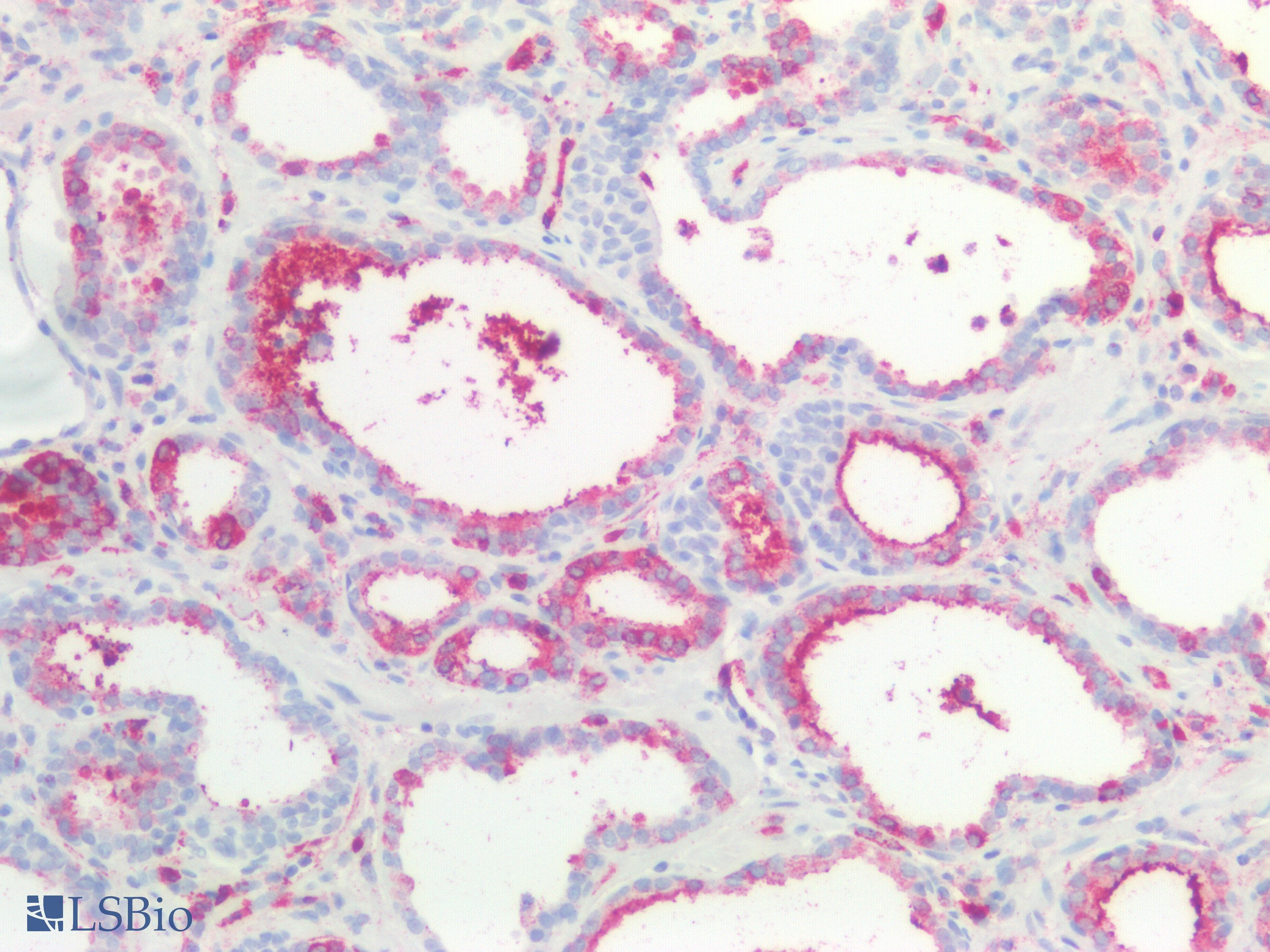 PathPlus™ CTNNBIP1 / ICAT Antibody (aa1-81)