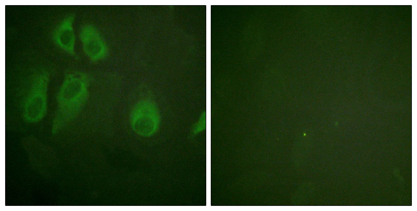 IL2RA / CD25 Antibody (aa223-272)