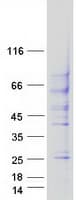 Human TGFBR2 Protein (Recombinant Myc-DDK (Flag))