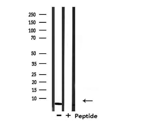 Polyclonal Rabbit anti-Human COX17 Antibody (IHC, IF, WB)
