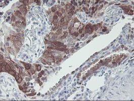 IRF6 Antibody (clone OTI2C10, Carrier-free)