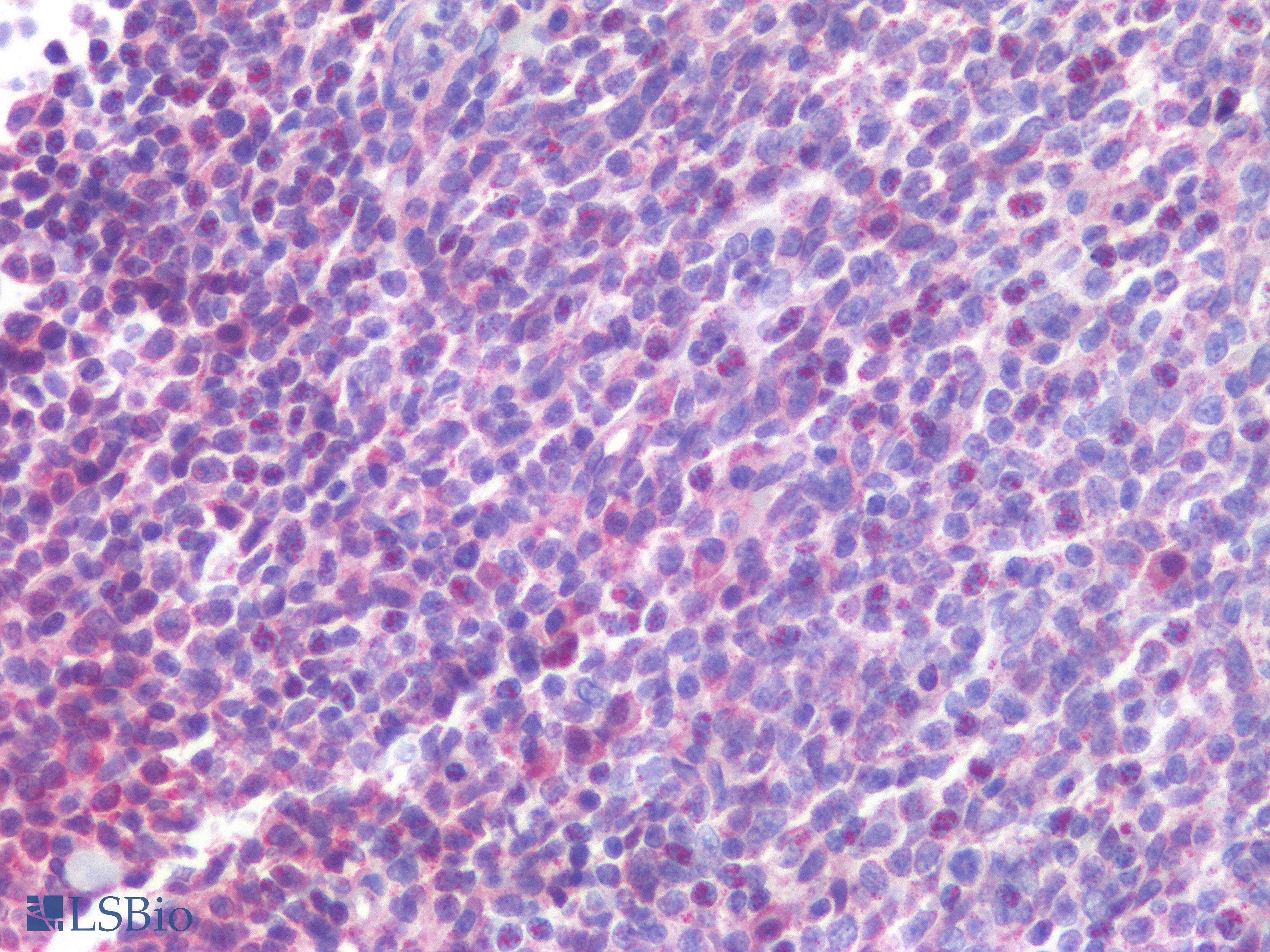 IHC-plus™ Polyclonal Rabbit anti-Human CD300A Antibody (IHC)