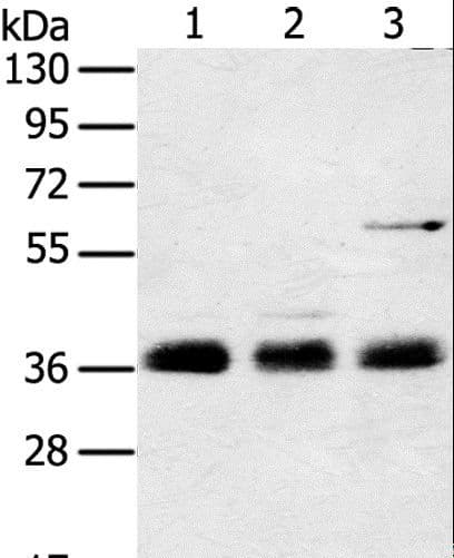 Polyclonal Rabbit anti-Human CARP / ANKRD1 Antibody (IHC, WB)