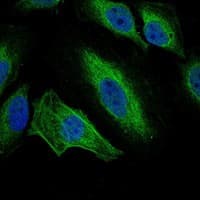 AURKA / Aurora-A Antibody (clone 1F8)