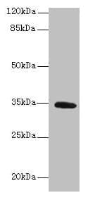 Polyclonal Rabbit anti-Human C5orf35 Antibody (WB)