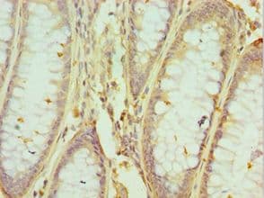HNRPM / HNRNPM Antibody (aa491-730)