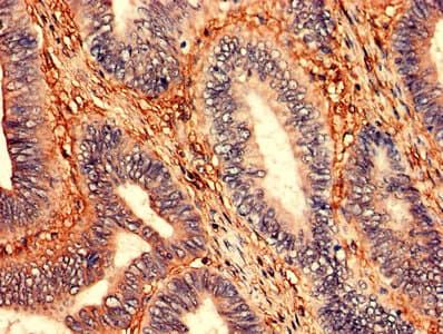 Polyclonal Rabbit anti-Human ZNF791 Antibody