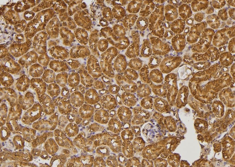 RALGAPA2 Antibody