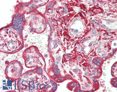 IHC-plus™ IRS2 / IRS-2 Antibody (aa1288-1338)