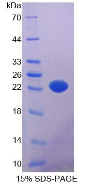 Mouse SGPL1 Protein (Recombinant His-S)