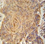 PCYOX1L Antibody (aa465-494)