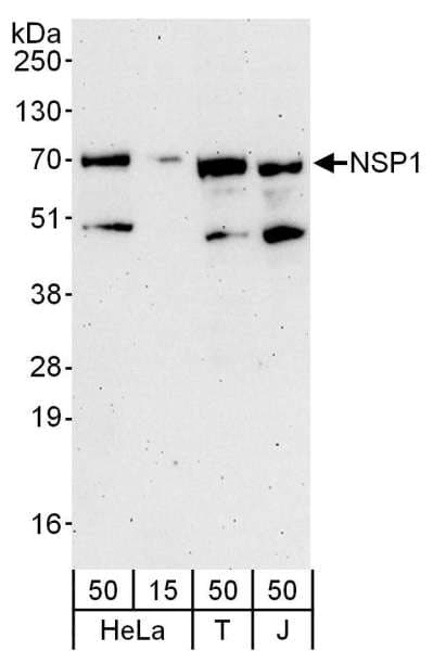 Polyclonal Rabbit anti-Human SH2D3A / NSP1 Antibody (aa100-150, WB)
