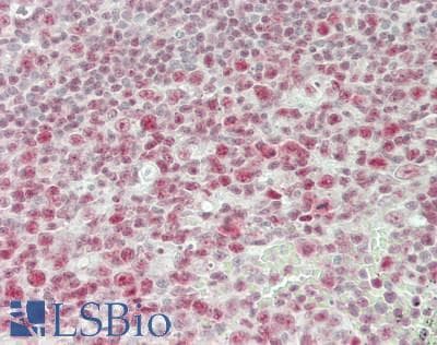 IHC-plus™ SFRS7 / 9G8 Antibody (aa188-238)